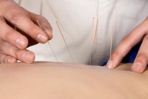 10 Ways that Acupuncture Can Support Women’s Health