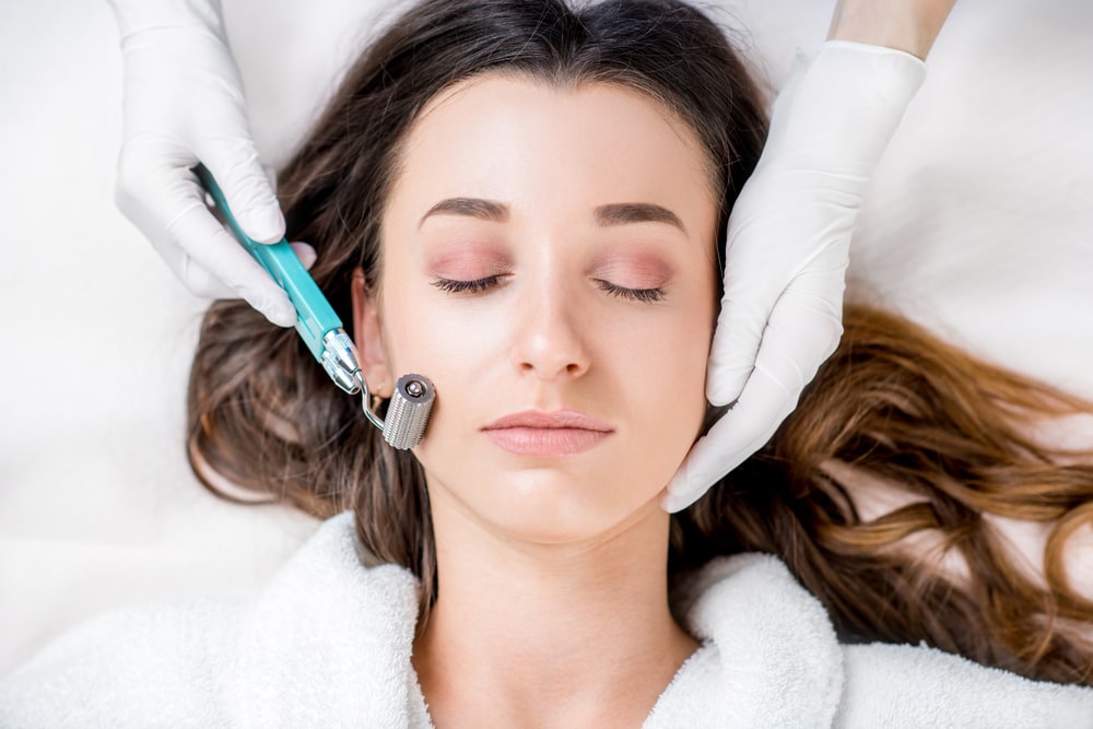 Microneedling