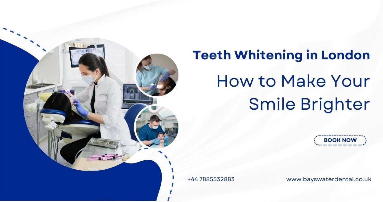 Teeth Whitening in London