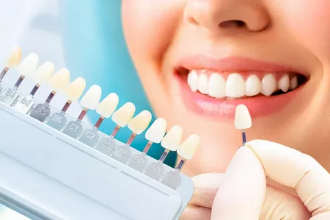 cosmetic dentistry in kalyan nagar