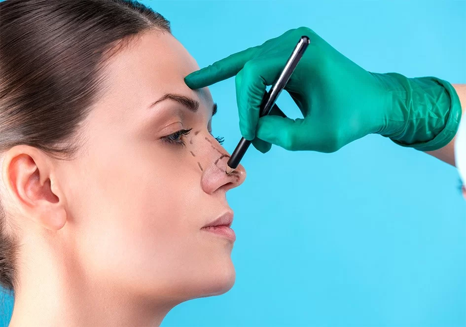 Rhinoplasty in Dubai (تجميل الأنف في دبي)