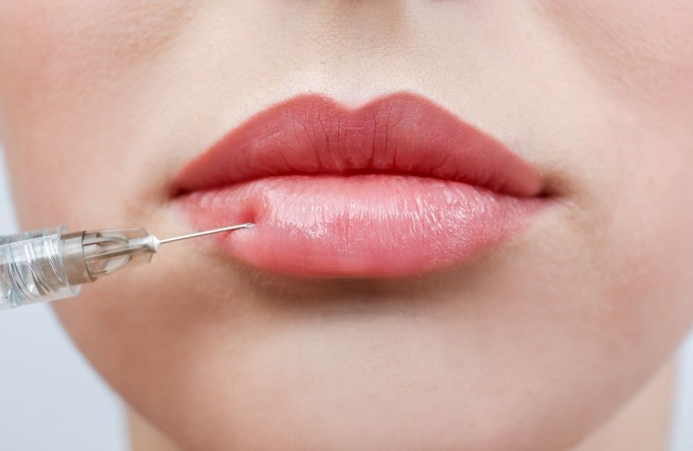 Lip filler injections in Dubai 