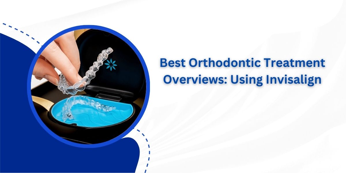 Best Orthodontics Treatment in London