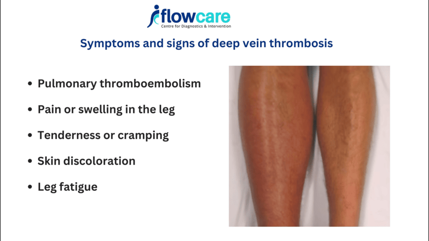 Minimally Invasive Pain Management