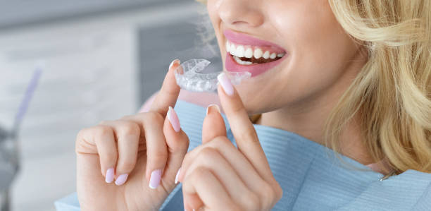 Invisalign in Karach