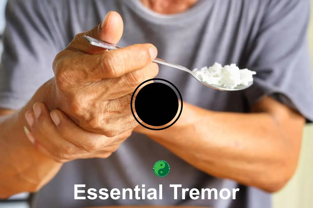 Natural Treatments for Essential Tremor