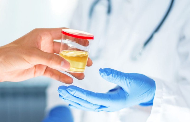 urine test