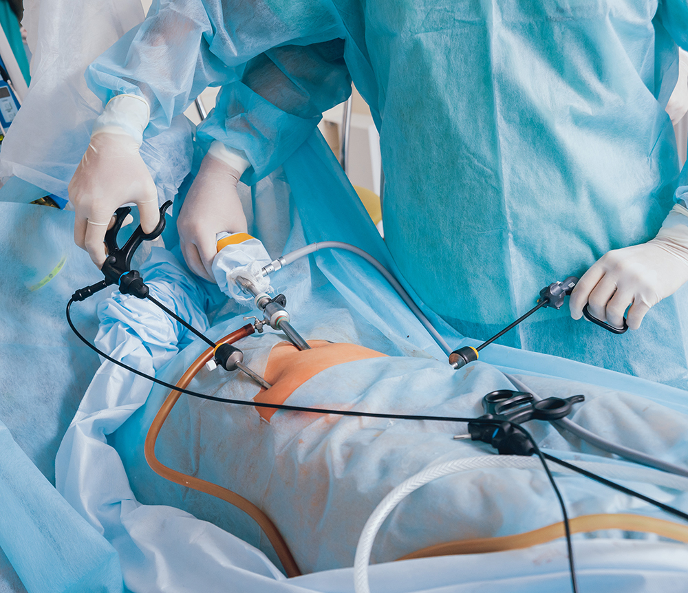 Laparoscopic Surgery in Dubai