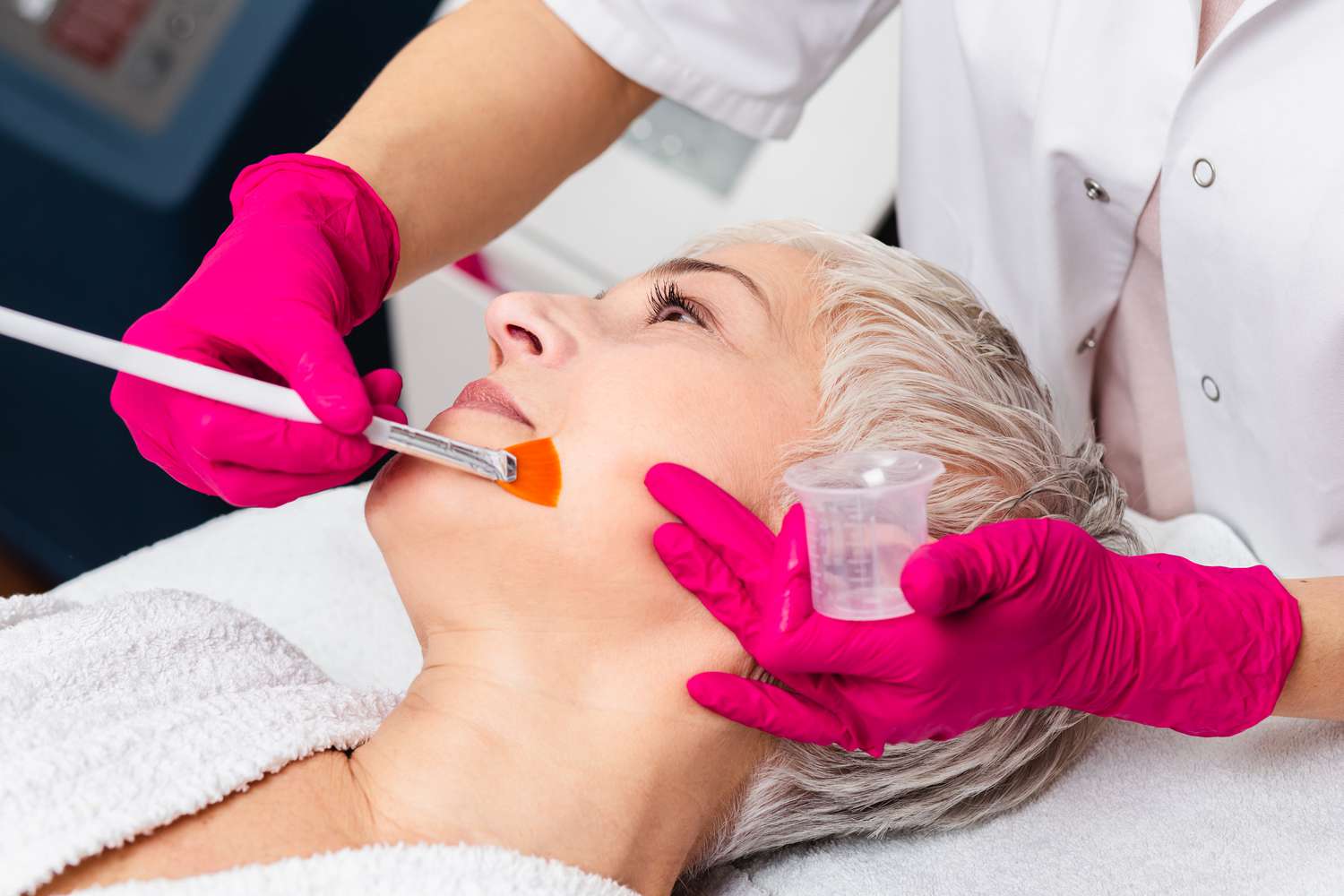 Chemical peels in Dubai (التقشير الكيميائي في دبي)
