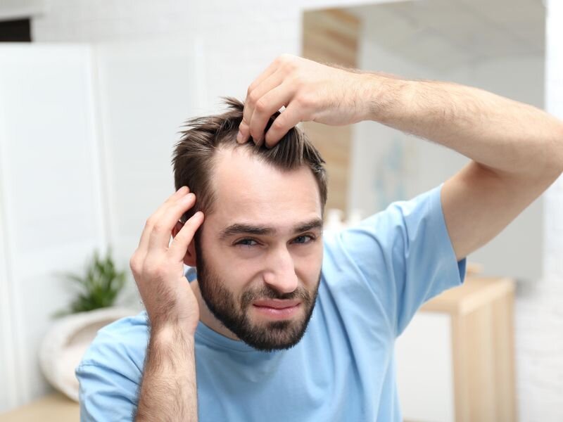 Hair Transplant in Dubai