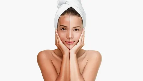 Skin whitening in Islamabad