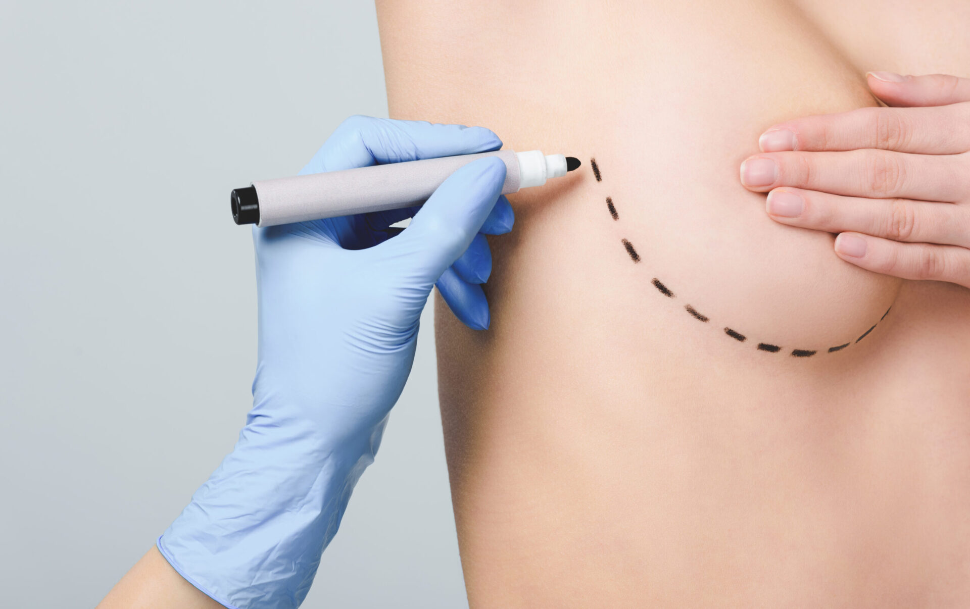 Breast Implants in Islamabad