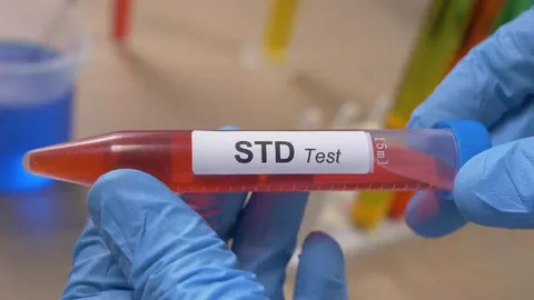 STD Test in Dubai